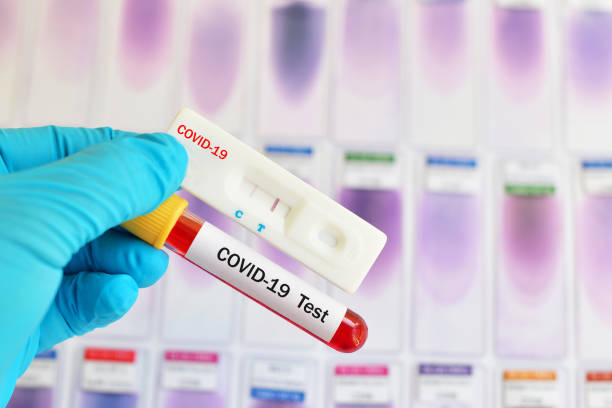 Read more about the article The Rising Need for Reliable Widespread COVID-19 Testing